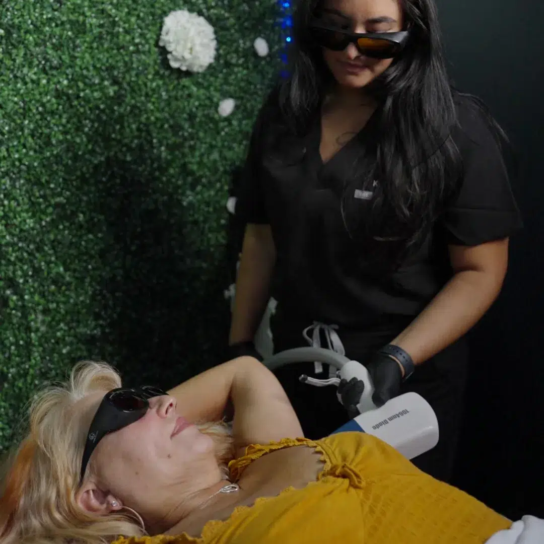 laser hair removal