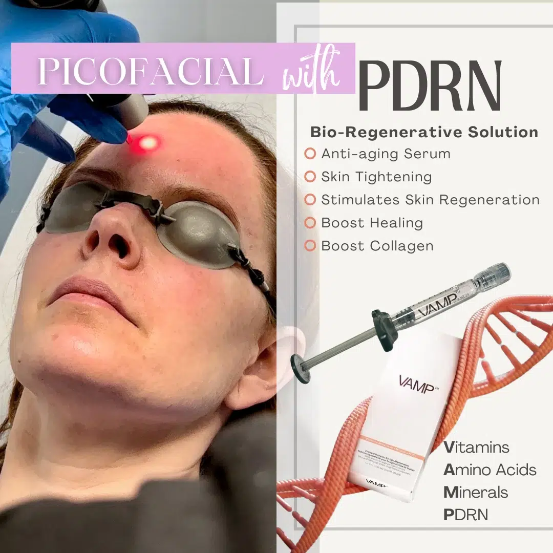 Pico & PDRN